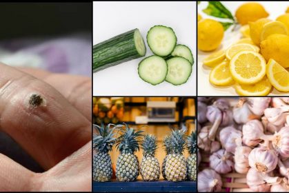 cara hilangkan ketuat