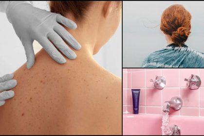 Ramai Malu Sebab Ada Jerawat Belakang Badan