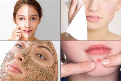 kulit wajah alami breakout