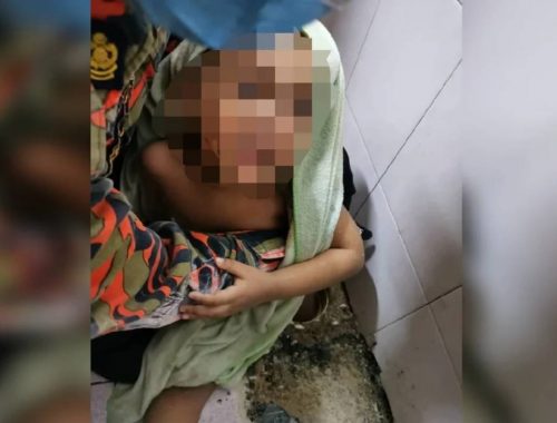 Kaki Tersepit Hampir 3 Jam, Bomba Pasang Video Kartun Lekakan Budak Lelaki Ketika Operasi