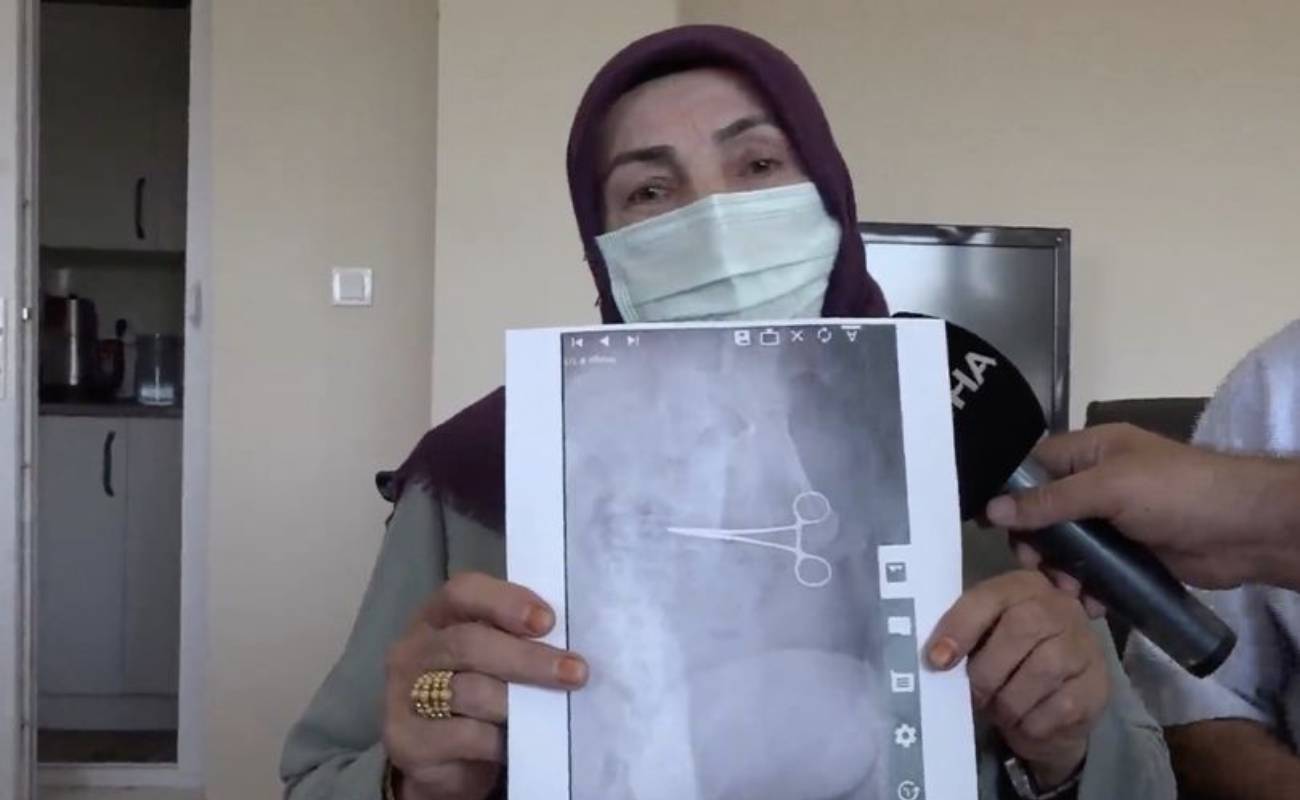 Nurcihan Ogmen Menderita Selepas Pembedahan, Rupa-Rupanya Gunting Tertinggal Dalam Perut