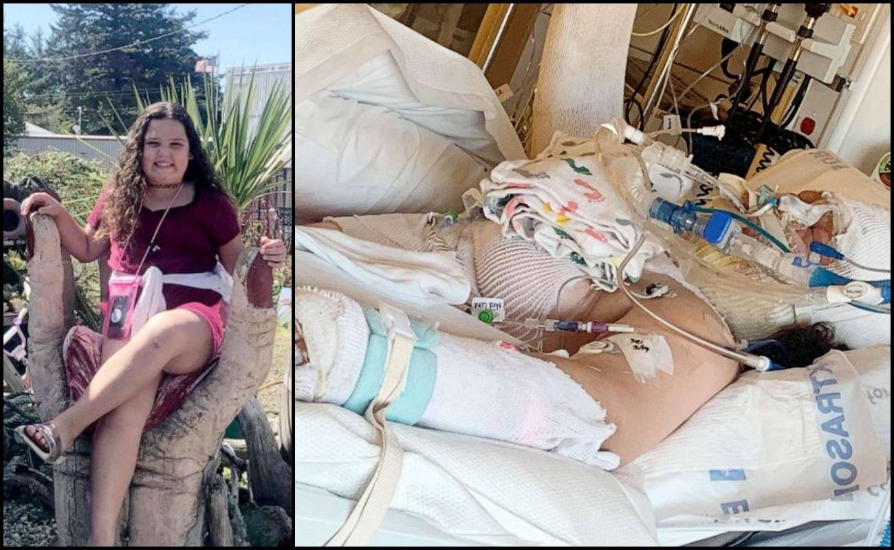 Terpengaruh Dengan Cabaran Di Sosial Media, Gadis Ini Terpaksa Bertarung Nyawa