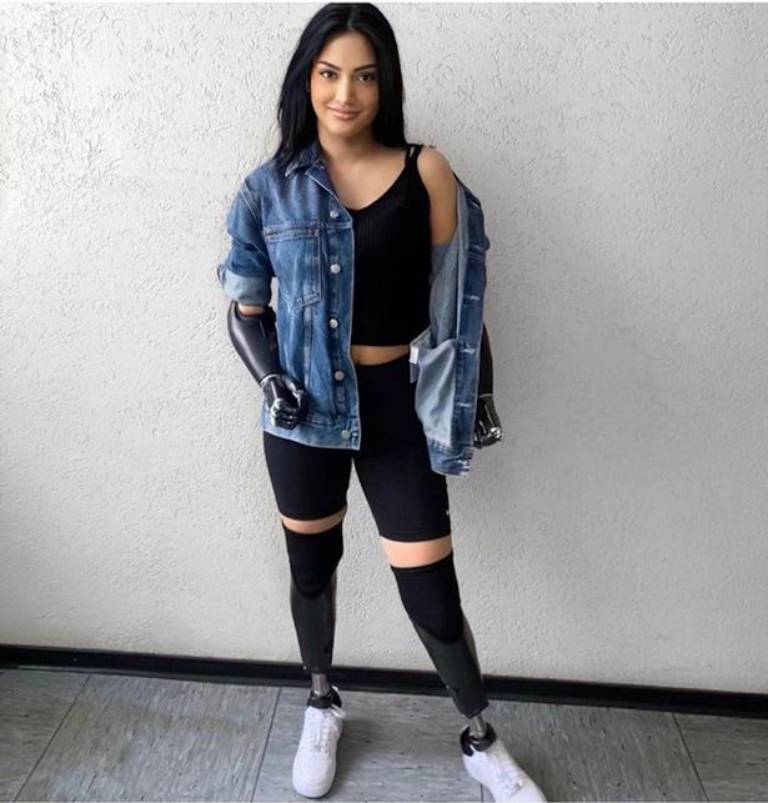 Beyza Dogan terpaksa membuang dan mengasingkan keempat-empat anggota badannya Beyza Dogan terpaksa membuang dan mengasingkan keempat-empat anggota badannya