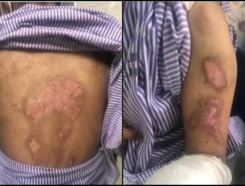 Gadis Sindrom Down Ini Didakwa Mangsa Dera Di Rumah Kebajikan