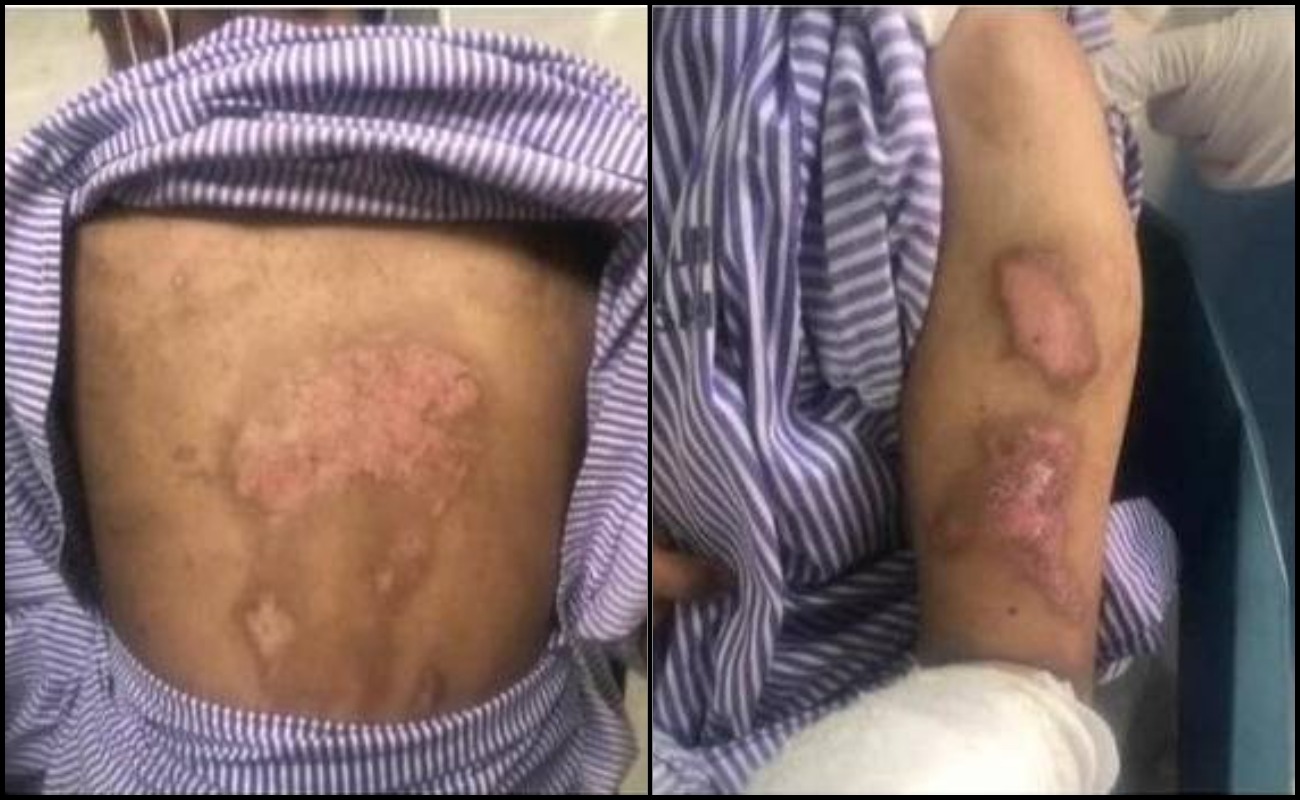 Gadis Sindrom Down Ini Didakwa Mangsa Dera Di Rumah Kebajikan