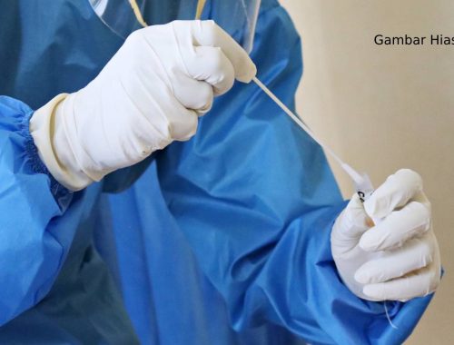 Awas! Virus Marburg Dikesan Lebih Mudah Menjangkiti & Tersebar