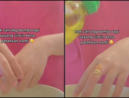 Cincin Ketat & Sukar Ditanggalkan Gara-Gara PKP, Gadis Ini Trauma!