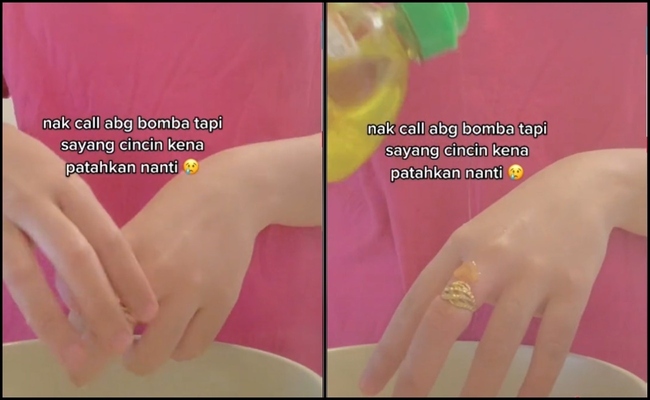 Cincin Ketat & Sukar Ditanggalkan Gara-Gara PKP, Gadis Ini Trauma!