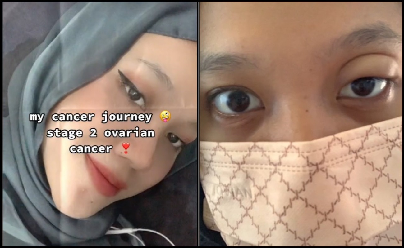 Disangka Mengandung Kerana Buncit, Rupanya Kanser Ovari Tahap Dua