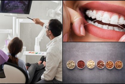 Cantiknya Pakai Braces! Ini Dia Pantang Larang & Tip Penjagaan Pendakap Gigi