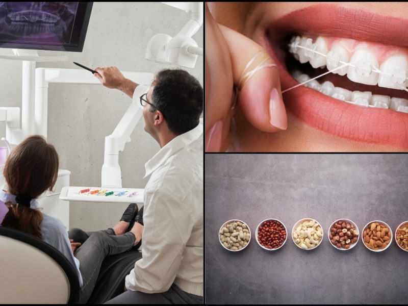 Cantiknya Pakai Braces! Ini Dia Pantang Larang & Tip Penjagaan Pendakap Gigi