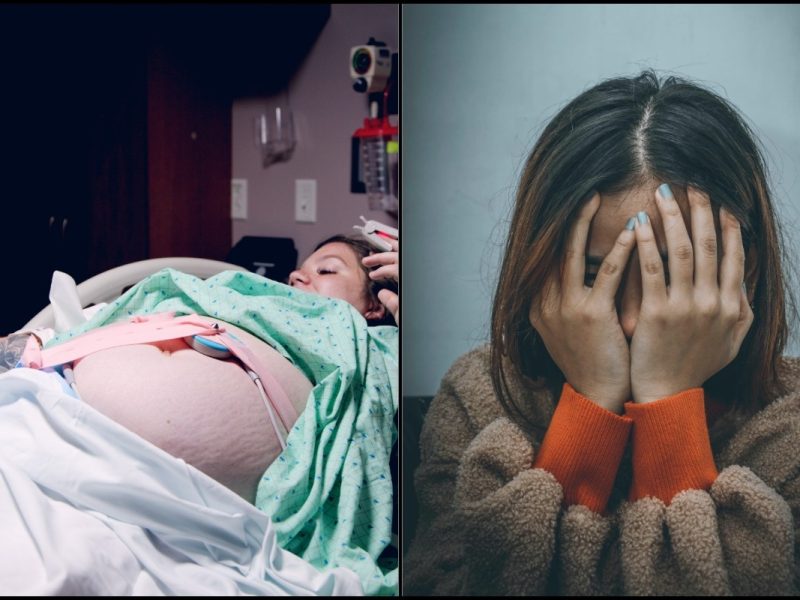 Insecure Dengan Stretch Mark, Cuba Dua Kaedah!