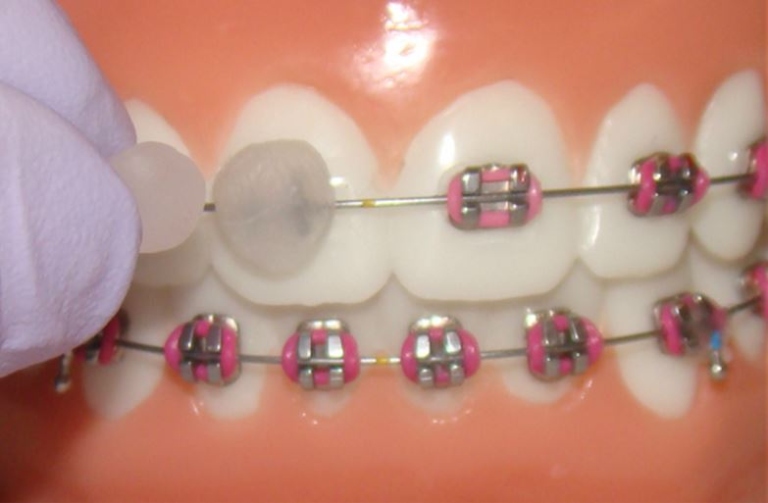 dental wax (1)