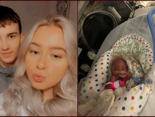 Bayi Terkecil Lahir Seberat 325 Gram Dalam Tempoh 20 Tahun!