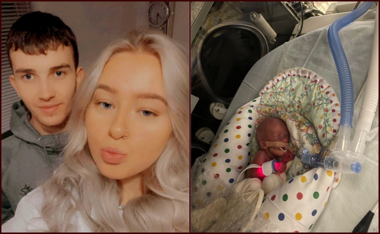 Bayi Terkecil Lahir Seberat 325 Gram Dalam Tempoh 20 Tahun!