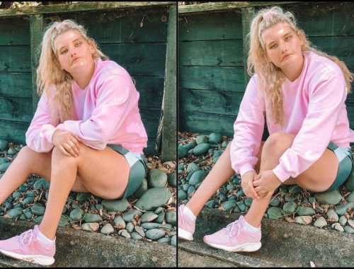 Tak Pernah Senyum Seumur Hidup! Bekas Atlet Hidap Sindrom Moebius Pernah Kemurungan Teruk