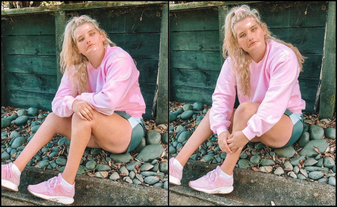 Tak Pernah Senyum Seumur Hidup! Bekas Atlet Hidap Sindrom Moebius Pernah Kemurungan Teruk