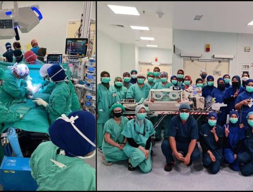 Cipta Sejarah! Pasangan Kembar Siam Pramatang 17 Hari Berjaya Dipisahkan!