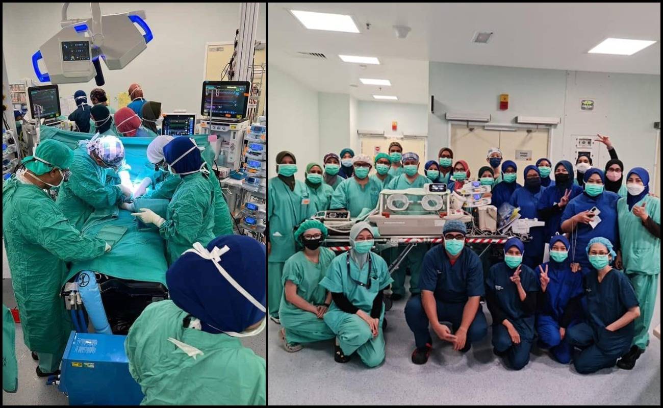 Cipta Sejarah! Pasangan Kembar Siam Pramatang 17 Hari Berjaya Dipisahkan!