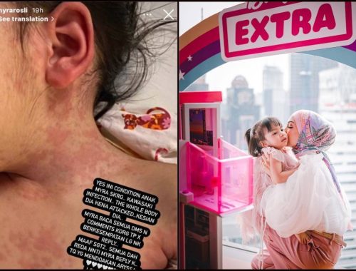 Anak Amyra Rosli Jatuh Sakit, Ibu Bapa Kena Pantau Simptom Virus Kawasaki!