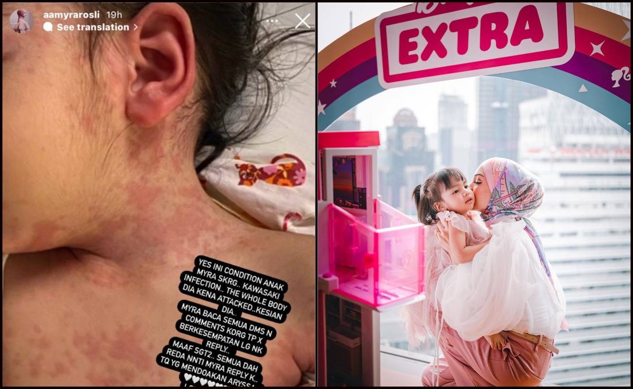 Anak Amyra Rosli Jatuh Sakit, Ibu Bapa Kena Pantau Simptom Virus Kawasaki!