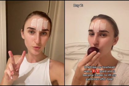 Wanita Tepek Pita Pelekat Di Dahi, Katanya Boleh Cegah Kedutan_