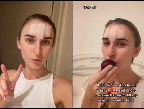 Wanita Tepek Pita Pelekat Di Dahi, Katanya Boleh Cegah Kedutan_