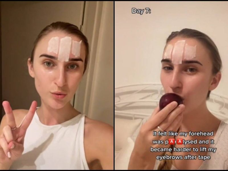 Wanita Tepek Pita Pelekat Di Dahi, Katanya Boleh Cegah Kedutan_