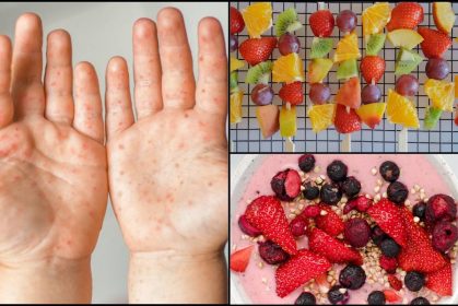 Anak Dijangkiti HFMD Cenderung Reject Makanan, Ibu Bapa Boleh Ikhtiar Dengan 4 Makanan Ini!