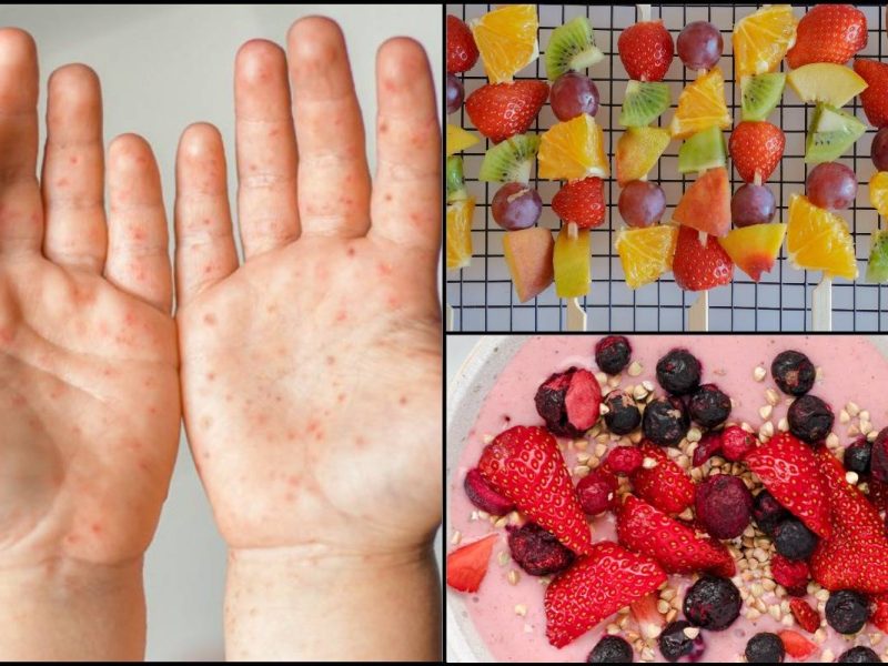 Anak Dijangkiti HFMD Cenderung Reject Makanan, Ibu Bapa Boleh Ikhtiar Dengan 4 Makanan Ini!