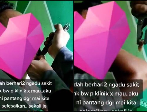 Cabut Gigi Guna Playar, Ramai Netizen Seram Tengok!