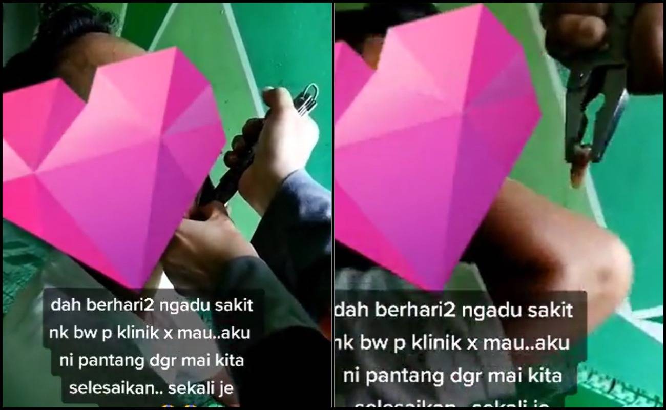 Cabut Gigi Guna Playar, Ramai Netizen Seram Tengok!