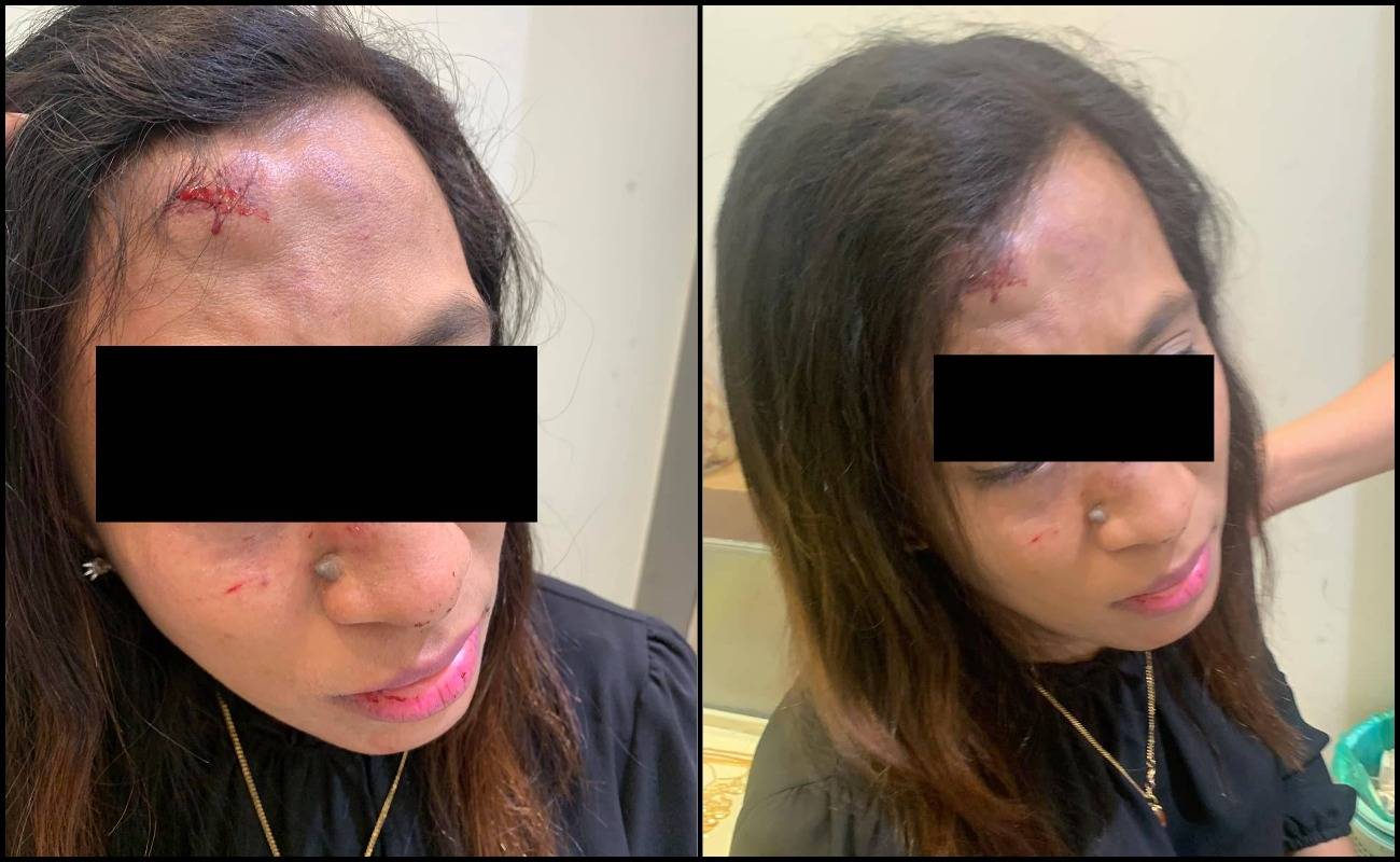 Dihentak 20 Kali Dengan ‘Handphone