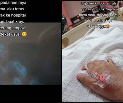 Gadis Tertelan Jarum Peniti Gara-Gara Kemam Di Bibir Sebelum Pakai Tudung