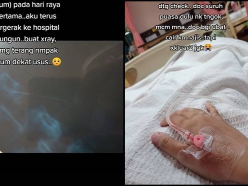 Gadis Tertelan Jarum Peniti Gara-Gara Kemam Di Bibir Sebelum Pakai Tudung