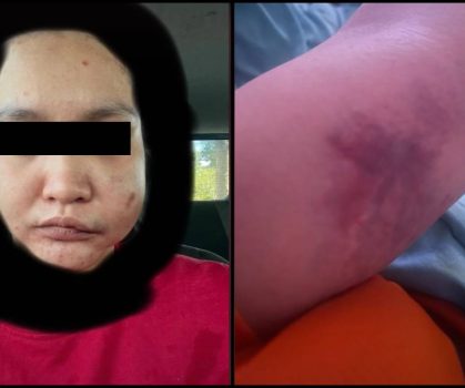 Kantoi Curang Tapi ‘Play Victim’, Lelaki Sanggup Lanyak Kekasih Hingga Separuh Mati!