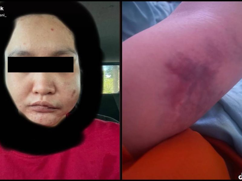 Kantoi Curang Tapi ‘Play Victim’, Lelaki Sanggup Lanyak Kekasih Hingga Separuh Mati!