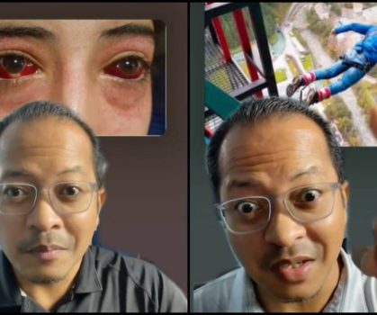 “Dah Kata Dah Jangan Main!” Doktor Kongsi Risiko Pesakit Rabun Jika Main Permainan Bungee Jumping