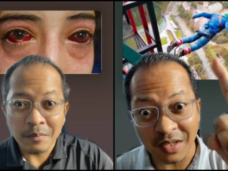“Dah Kata Dah Jangan Main!” Doktor Kongsi Risiko Pesakit Rabun Jika Main Permainan Bungee Jumping