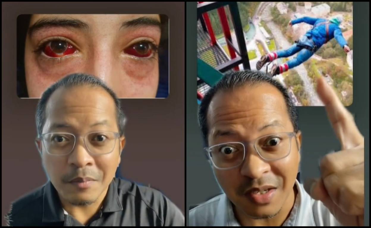 “Dah Kata Dah Jangan Main!” Doktor Kongsi Risiko Pesakit Rabun Jika Main Permainan Bungee Jumping