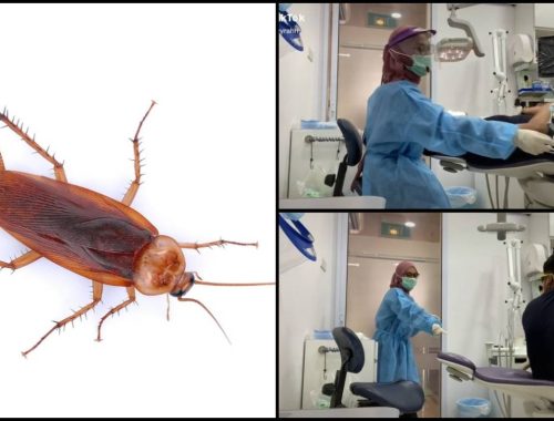 Lipas Oh Lipas! Doktor Gigi Dan Pesakit Melompat Panik Gara-Gara Makhluk Itu